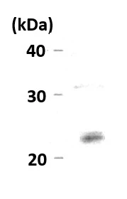 WB analysis of BHK cell Lysate using GTX00898 HP1 gamma antibody. WB analysis of BHK cell Lysate using GTX00898 HP1 gamma antibody.