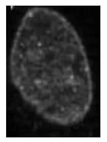 ICC/IF analysis of BHK cells using GTX00898 HP1 gamma antibody. Fixation : 4% PFA