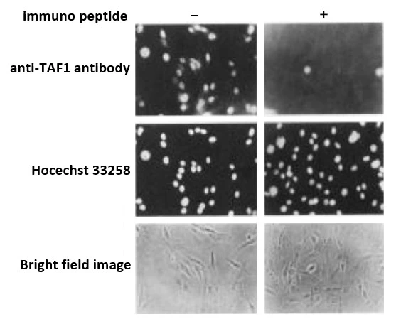 ICC/IF analysis of BHK cells using GTX00900 TAF1 antibody. TAF1 antibody pre-incubated with (right panel) or without (left panel) immunogen peptide.<br>Fixation : 3% formaldehyde<br>Permeabilization : 1% NP-40
