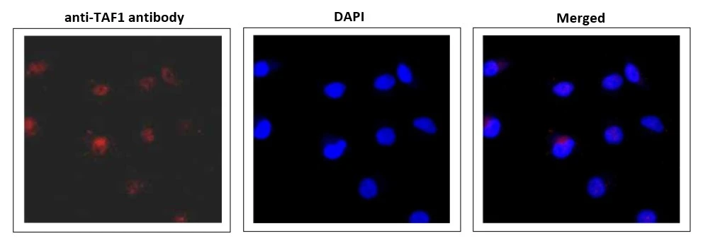 ICC/IF analysis of HeLa cells using GTX00900 TAF1 antibody. TAF1 protein was detected in nucleus. Fixation : 4% PFA Permeabilization : 0.25% Triton X-100 Dilution : 1:5000
