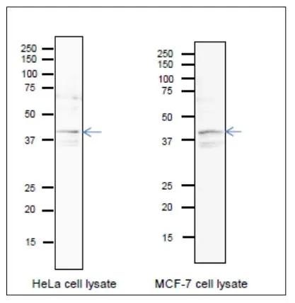 WB analysis of various samples using GTX00901 PURA antibody. Blotting was done in wet system at 15 v overnight. CanGetSignal (Toyobo, Osaka) was used as a signal enhancer. SDS-PAGE : 12.5% Left : HeLa whole cell lysate Right : MCF-7 whole cell lysate Dilution : 1:1000 WB analysis of various samples using GTX00901 PURA antibody. Blotting was done in wet system at 15 v overnight. CanGetSignal (Toyobo, Osaka) was used as a signal enhancer. SDS-PAGE : 12.5% Left : HeLa whole cell lysate Right : MCF-7 whole cell lysate Dilution : 1:1000