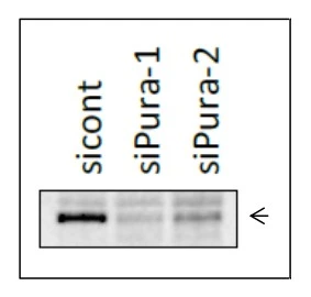 WB analysis of HCT116 whole cell lysate transfected with si-Pura for 48 hrs using GTX00901 PURA antibody.