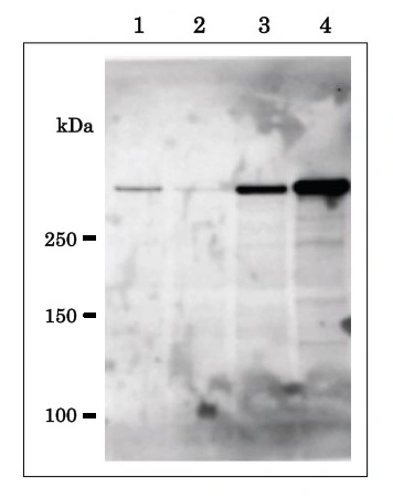 WB analysis of various samples using GTX00902 EDD antibody. Lane 1 : HeLa cells transfected with control siRNA Lane 2 : HeLa cells transfected with EDD-specific siRNA Lane 3 : HEK293T cells transfected with pFlag-CMV-5b empty vector Lane 4 : HEK293T cells transfected with pCMV-Tag2b-EDD expression vector WB analysis of various samples using GTX00902 EDD antibody. Lane 1 : HeLa cells transfected with control siRNA Lane 2 : HeLa cells transfected with EDD-specific siRNA Lane 3 : HEK293T cells transfected with pFlag-CMV-5b empty vector Lane 4 : HEK293T cells transfected with pCMV-Tag2b-EDD expression vector