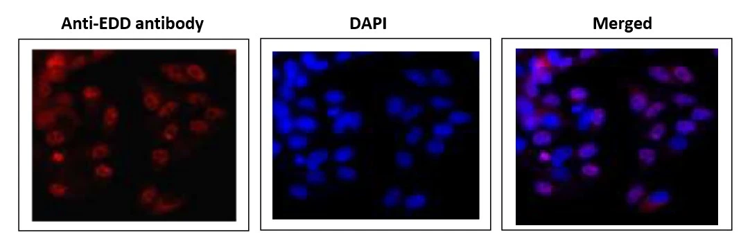 ICC/IF analysis of MCF-7 cells using GTX00902 EDD antibody. Fixation : 4% PFA, overnight Permeabilization : 0.25% Triton X-100 in PBS, 10 min Dilution : 1:1000