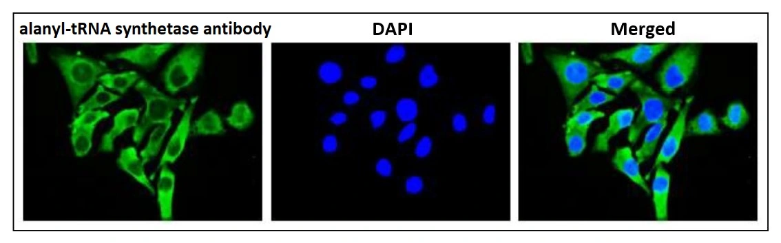 ICC/IF analysis of HeLa cells using GTX00903 alanyl-tRNA synthetase antibody. Fixation : 4% PFA Permeabilization : 0.25% Triton X-100 Dilution : 1:100