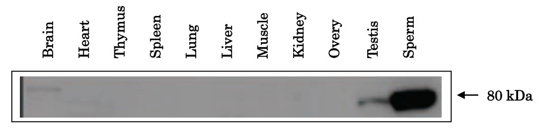 WB analysis of various mouse tissue samples using GTX00904 ACE3 antibody. Dilution : 1:500 Loading : 30 microg WB analysis of various mouse tissue samples using GTX00904 ACE3 antibody. Dilution : 1:500 Loading : 30 microg