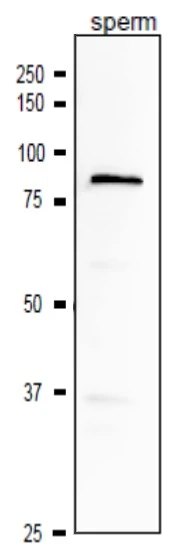 WB analysis of mouse sperm using GTX00904 ACE3 antibody. Dilution : 1:1000 Loading : 10 microg SDS-PAGE : 10%
