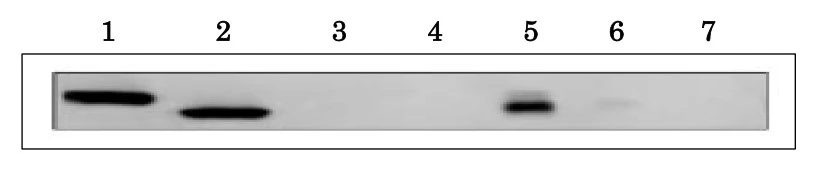 WB analysis of various samples using GTX00911 Ferredoxin 1 + Ferredoxin 2 antibody. The Maize leaf type specific antibody, anti-Ferredoxin-1 antibody also specifically reacts with Arabidopsis leaf type ferredoxins, 1 and 2 isoproteins. Lane 1 : Recombinant At-Feredoxin-1 (200 nmol) Lane 2 : Recombinant At-Ferredoxin-2 (200 nmol) Lane 3 : Recombinant At-Ferredoxin-3 (200 nmol) Lane 4 : Recombinant At-Ferredoxin-4 (20 nmol) Lane 5 : Leaf extract of Arabidopsis, soluble fraction with 70% saturated ammonium sulfate Lane 6 : Leaf extract of Arabidopsis, insoluble fraction with 70% saturated ammonium sulfate Lane 7 : Root extract of Arabidopsis
