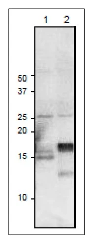 WB analysis of various samples using GTX00912 Ferredoxin 3 antibody. Lane 1 : Arabidopsis leaf extract (10 microg) Lane 2 : Maize leaf extract (10 microg) Dilution : 1:1000