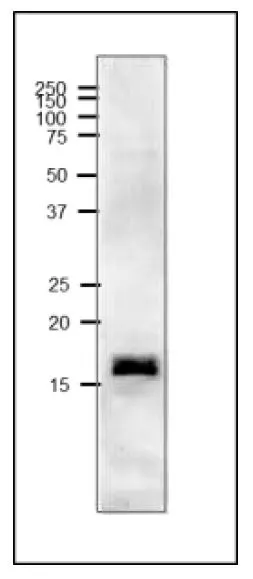 WB analysis of crude extract of Cyanobacterium Synechocystis sp. PCC 6803 using GTX00914 Ferredoxin 2 antibody. Dilution : 1:1000 SDS-PAGE : 15%