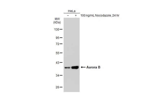 Untreated (-) and treated (+) HeLa whole cell extracts (30 microg) were separated by 10% SDS-PAGE, and the membrane was blotted with Aurora B antibody [GT1146] (GTX00916) diluted at 1:500. The HRP-conjugated anti-rabbit IgG antibody (GTX213110-01) was used to detect the primary antibody.