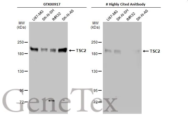 Various whole cell extracts (30 microg) were separated by 5% SDS-PAGE, and the membranes were blotted with TSC2 antibody [GT1147] (GTX00917) diluted at 1:1000 and competitors antibody diluted at 1:1000. The HRP-conjugated anti-rabbit IgG antibody (GTX213110-01) was used to detect the primary antibody. *The competitor is not affiliated with GeneTex and does not endorse this product.