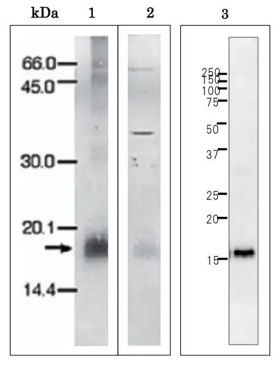 WB analysis of various samples using GTX00920 Plasmodium falciparum Ferredoxin antibody. Molecular mass of Pf Fd is 18 kDa. Lane 1 : Purified recombinant P. falciparum Ferredoxin (10 ng) Lane 2 : Partially purified Ferredoxin protein from culture of P. falciparum Lane 3 : Purified recombinant P. falciparum Ferredoxin (1.4 ng) Dilution : 1:1000 WB analysis of various samples using GTX00920 Plasmodium falciparum Ferredoxin antibody. Molecular mass of Pf Fd is 18 kDa. Lane 1 : Purified recombinant P. falciparum Ferredoxin (10 ng) Lane 2 : Partially purified Ferredoxin protein from culture of P. falciparum Lane 3 : Purified recombinant P. falciparum Ferredoxin (1.4 ng) Dilution : 1:1000