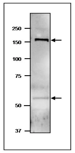 WB analysis of soluble fraction of Synechocystis sp. PCC6803 extract using GTX00922 GltB + GltD antibody. Molecular mass of GltB (large subunit of NADPH-dependent GOGAT) is 168 kDa, GltD (small subunit of NADPH-dependent GOGAT) is 54 kDa. Dilution : 4 microg/ml WB analysis of soluble fraction of Synechocystis sp. PCC6803 extract using GTX00922 GltB + GltD antibody. Molecular mass of GltB (large subunit of NADPH-dependent GOGAT) is 168 kDa, GltD (small subunit of NADPH-dependent GOGAT) is 54 kDa. Dilution : 4 microg/ml