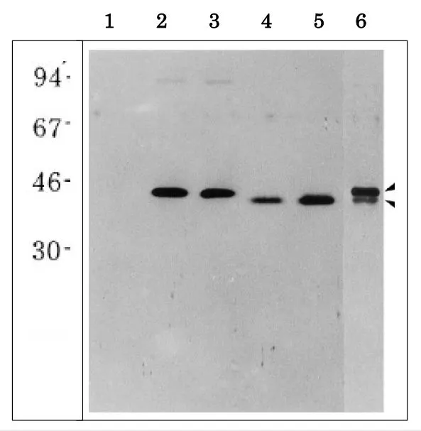 WB analysis of various samples using GTX00924 Glutamine Synthetase antibody. The lower band is ammonia induced GS. Lane 1 : Negative control without recombinant GS Lane 2 : GS1-1 expressing extract Lane 3 : GS1-2 expressing extract Lane 4 : GS1-3 expressing extract Lane 5 : GS1-4 expressing extract Lane 6 : Maize root extract treated with ammonia WB analysis of various samples using GTX00924 Glutamine Synthetase antibody. The lower band is ammonia induced GS. Lane 1 : Negative control without recombinant GS Lane 2 : GS1-1 expressing extract Lane 3 : GS1-2 expressing extract Lane 4 : GS1-3 expressing extract Lane 5 : GS1-4 expressing extract Lane 6 : Maize root extract treated with ammonia