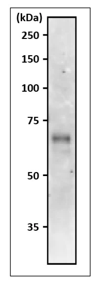 WB analysis of Arabidopsis leaf extract using GTX00925 Asparagine synthetase antibody. Molecular mass of Arabidopsis ASN2 is 65 kDa. Dilution : 1:1000 Loading : 10 microg WB analysis of Arabidopsis leaf extract using GTX00925 Asparagine synthetase antibody. Molecular mass of Arabidopsis ASN2 is 65 kDa. Dilution : 1:1000 Loading : 10 microg