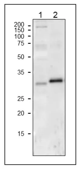 WB analysis of various samples using GTX00930 Cytochrome f antibody. Molecular masses of maize Cyt f is 35 kDa (Arabidopsis), 36 kDa (maize). The differences between the predicted sizes and WB data reflect signal peptide removal in mature proteins. Lane 1 : Arabidopsis leaf extract Lane 2 : Maize leaf extract Dilution : 1:1000 Loading : 10 microg WB analysis of various samples using GTX00930 Cytochrome f antibody. Molecular masses of maize Cyt f is 35 kDa (Arabidopsis), 36 kDa (maize). The differences between the predicted sizes and WB data reflect signal peptide removal in mature proteins. Lane 1 : Arabidopsis leaf extract Lane 2 : Maize leaf extract Dilution : 1:1000 Loading : 10 microg