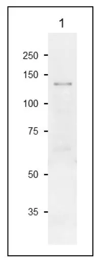 WB analysis of maize leaf extract using GTX00931 Sucrose-Phosphate Synthase antibody. Dilution : 1:500 Loading : 20 microg