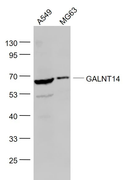 WB analysis of various sample lysates using GTX00937 GALNT14 antibody.<br>Lane 1 : A549 cell lysates<br>Lane 2 : MG63 cell lysates<br>Dilution : 1:1000