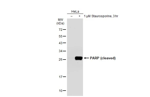 Untreated (-) and treated (+) HeLa whole cell extracts (30 microg) were separated by 12% SDS-PAGE, and the membrane was blotted with PARP (cleaved) antibody [GT1181] (GTX00943) diluted at 1:500. The HRP-conjugated anti-rabbit IgG antibody (GTX213110-01) was used to detect the primary antibody.