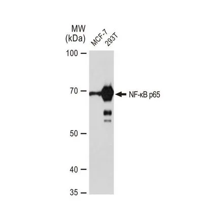 WB analysis of various samples using GTX00947 NFkB p65 antibody [GT1185].<br>Dilution : 1:1000<br>Loading : 25?g