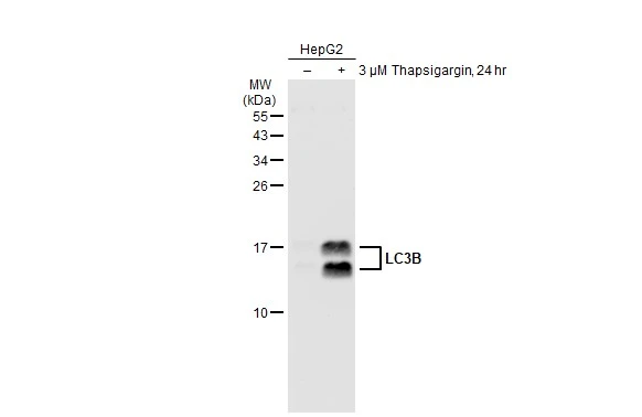 Untreated (-) and treated (+) HepG2 whole cell extracts (30 microg) were separated by 15% SDS-PAGE, and the membrane was blotted with LC3B antibody [GT1187] (GTX00949) diluted at 1:500. The HRP-conjugated anti-rabbit IgG antibody (GTX213110-01) was used to detect the primary antibody.
