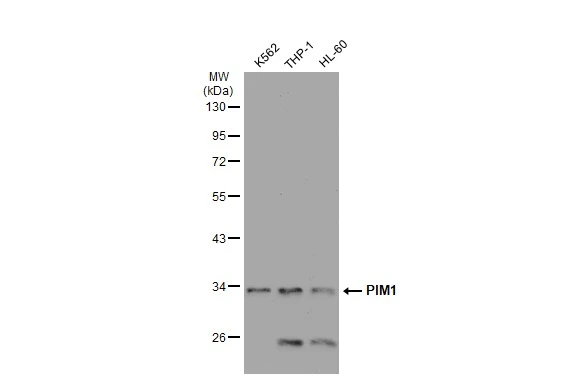 Various whole cell extracts (30 ?g) were separated by 10% SDS-PAGE, and the membrane was blotted with PIM1 antibody [GT1192] (GTX00954) diluted at 1:1000. The HRP-conjugated anti-rabbit IgG antibody (GTX213110-01) was used to detect the primary antibody.