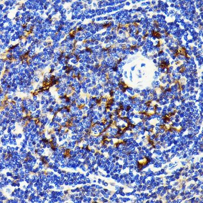 IHC-P analysis of Rat spleen tissue section using GTX00955 SQSTM1 / P62 antibody [GT1193].<br>Dilution : 1:100