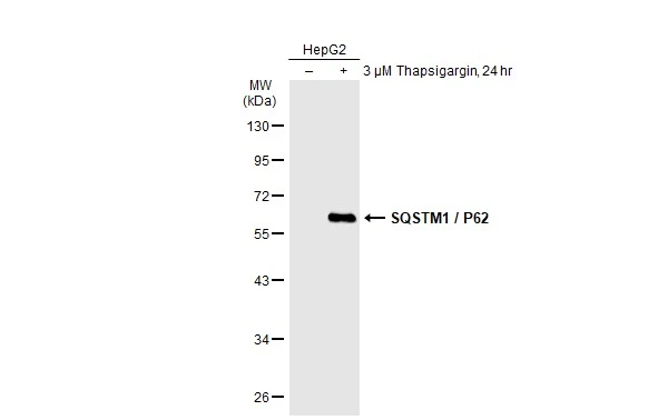 Untreated (-) and treated (+) HepG2 whole cell extracts (30 microg) were separated by 10% SDS-PAGE, and the membrane was blotted with SQSTM1 / P62 antibody [GT1193] (GTX00955) diluted at 1:500. The HRP-conjugated anti-rabbit IgG antibody (GTX213110-01) was used to detect the primary antibody.