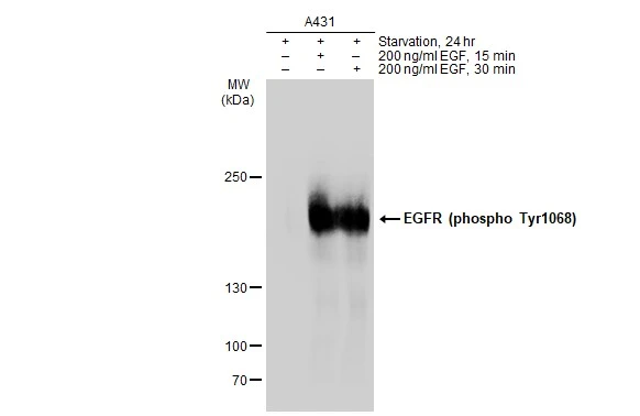 Untreated (-) and treated (+) A431 whole cell extracts (30 microg) were separated by 5% SDS-PAGE, and the membrane was blotted with EGFR (phospho Tyr1068) antibody [GT1196] (GTX00958) diluted at 1:1000. The HRP-conjugated anti-rabbit IgG antibody (GTX213110-01) was used to detect the primary antibody.