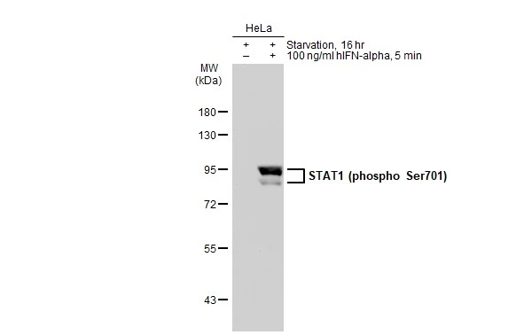 Untreated (-) and treated (+) HeLa whole cell extracts (30 microg) were separated by 7.5% SDS-PAGE, and the membrane was blotted with STAT1 (phospho Ser701) antibody [GT1197] (GTX00959) diluted at 1:500. The HRP-conjugated anti-rabbit IgG antibody (GTX213110-01) was used to detect the primary antibody.