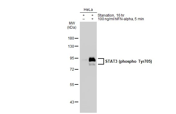Untreated (-) and treated (+) HeLa whole cell extracts (30 microg) were separated by 7.5% SDS-PAGE, and the membrane was blotted with STAT3 (phospho Tyr705) antibody [GT1204] (GTX00966) diluted at 1:500. The HRP-conjugated anti-rabbit IgG antibody (GTX213110-01) was used to detect the primary antibody.