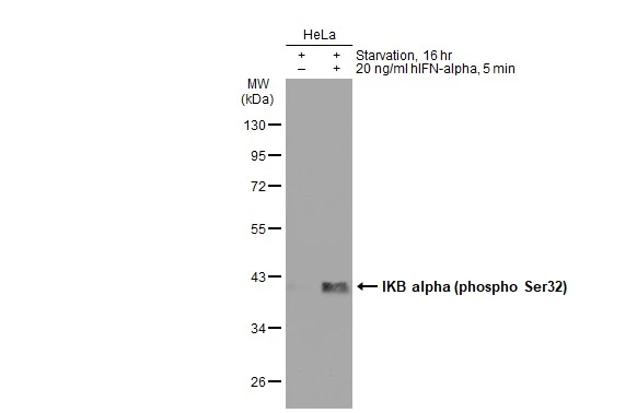 Untreated (-) and treated (+) HeLa whole cell extracts (30 microg) were separated by 10% SDS-PAGE, and the membrane was blotted with IKB alpha (phospho Ser32) antibody [GT1205] (GTX00967) diluted at 1:500. The HRP-conjugated anti-rabbit IgG antibody (GTX213110-01) was used to detect the primary antibody.