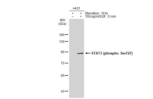 Untreated (-) and treated (+) A431 whole cell extracts (30 microg) were separated by 7.5% SDS-PAGE, and the membrane was blotted with STAT3 (phospho Ser727) antibody [GT1206] (GTX00968) diluted at 1:500. The HRP-conjugated anti-rabbit IgG antibody (GTX213110-01) was used to detect the primary antibody.