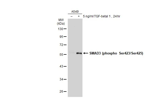 Untreated (-) and treated (+) A549 whole cell extracts (30 microg) were separated by 10% SDS-PAGE, and the membrane was blotted with SMAD3 (phospho Ser423/Ser425) antibody [GT1207] (GTX00969) diluted at 1:500. The HRP-conjugated anti-rabbit IgG antibody (GTX213110-01) was used to detect the primary antibody.