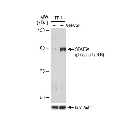 WB analysis of TF-1 cell extracts with/without GM-CSF (25 ng/ml, 37�C, 30 mins) treatment after serum-starvation overnight using GTX00970 STAT5A (phospho Tyr694) antibody [GT1208].<br>Dilution : 1:1000<br>Loading : 25 ?g