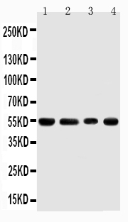 WB analysis of various sample lysates using GTX00972 TRAF4 antibody.<br>Lane 1 : Rat Thymus Tissue Lysate<br>Lane 2 : HeLa Cell Lysate<br>Lane 3 : Jurkat Cell Lysate<br>Lane 4: Hepa Cell Lysate