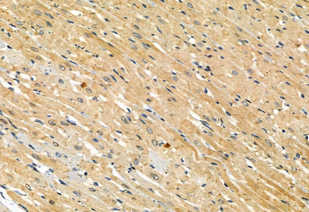 IHC-P analysis of rat heart tissue using GTX00973 MLKL (phospho Ser358) antibody. The sample was formaldehyde fixed and a heat mediated antigen retrieval step in citrate buffer was performed.<br>Dilution : 1:100