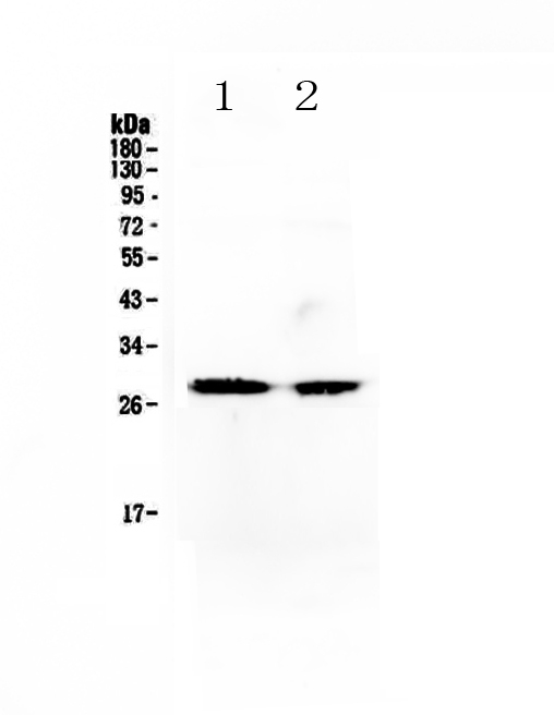 WB analysis of various sample lysates using GTX00974 MYF5 antibody.<br>Lane 1 : SW620 cell lysates<br>Lane 2 : mouse testis tissue lysates<br>Dilution : 0.5?g/ml<br>Loading : 50?g