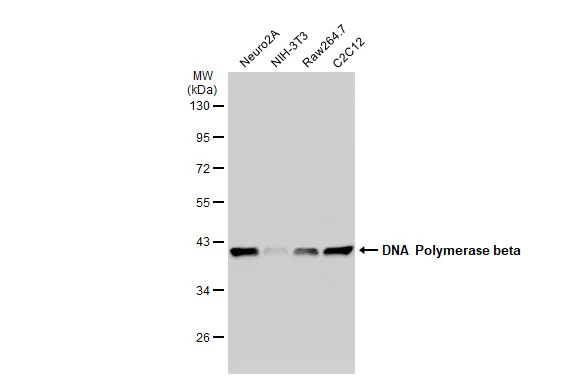 Various whole cell extracts (30 microg) were separated by 10% SDS-PAGE, and the membrane was blotted with DNA polymerase beta antibody [JM93-12] (GTX00983) diluted at 1:1000. The HRP-conjugated anti-rabbit IgG antibody (GTX213110-01) was used to detect the primary antibody.