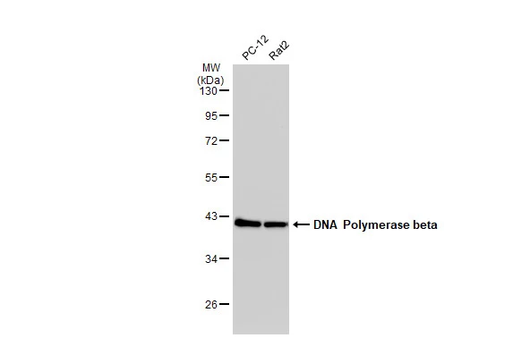 Various whole cell extracts (30 microg) were separated by 10% SDS-PAGE, and the membrane was blotted with DNA polymerase beta antibody [JM93-12] (GTX00983) diluted at 1:1000. The HRP-conjugated anti-rabbit IgG antibody (GTX213110-01) was used to detect the primary antibody.
