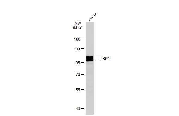 Whole cell extract (30 microg) was separated by 7.5% SDS-PAGE, and the membrane was blotted with SP1 antibody [JF0950] (GTX01012) diluted at 1:500. The HRP-conjugated anti-rabbit IgG antibody (GTX213110-01) was used to detect the primary antibody.