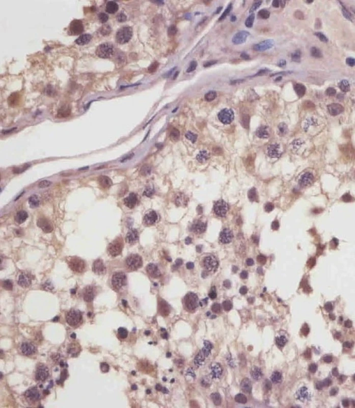 IHC-P analysis of human testis tissue sections using GTX01028 MGEA5 antibody. Antigen retrieval : Heat mediation with a citrate buffer (pH6) Dilution : 1:25