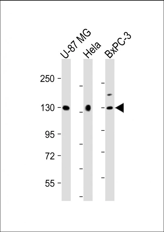 WB analysis of various sample lysates using GTX01028 MGEA5 antibody. Lane 1 : U-87 MG whole cell lysate Lane 2 : HeLa whole cell lysate Lane 3 : BxPC-3 whole cell lysate Dilution : 1:2000 Loading : 20 microg per lane