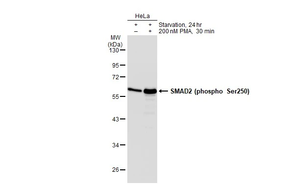 Untreated (-) and treated (+) HeLa whole cell extracts (30 microg) were separated by 10% SDS-PAGE, and the membrane was blotted with SMAD2 (phospho Ser250) antibody [SD207-1] (GTX01034) diluted at 1:500. The HRP-conjugated anti-rabbit IgG antibody (GTX213110-01) was used to detect the primary antibody.