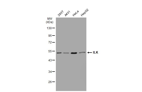 Various whole cell extracts (30 ?g) were separated by 10% SDS-PAGE, and the membrane was blotted with ILK antibody [SC68-04] (GTX01046) diluted at 1:500. The HRP-conjugated anti-rabbit IgG antibody (GTX213110-01) was used to detect the primary antibody.