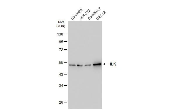 Various whole cell extracts (30 microg) were separated by 10% SDS-PAGE, and the membrane was blotted with ILK antibody [SC68-04] (GTX01046) diluted at 1:1000. The HRP-conjugated anti-rabbit IgG antibody (GTX213110-01) was used to detect the primary antibody.