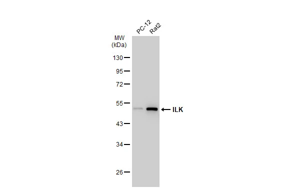 Various whole cell extracts (30 microg) were separated by 10% SDS-PAGE, and the membrane was blotted with ILK antibody [SC68-04] (GTX01046) diluted at 1:1000. The HRP-conjugated anti-rabbit IgG antibody (GTX213110-01) was used to detect the primary antibody.
