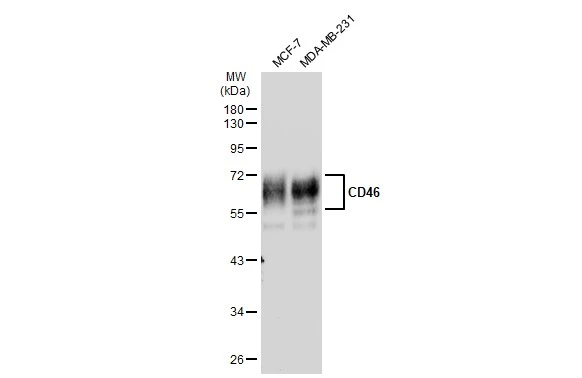 Various whole cell extracts (30 ?g) were separated by 10% SDS-PAGE, and the membrane was blotted with CD46 antibody [JB25-49] (GTX01058) diluted at 1:500. The HRP-conjugated anti-rabbit IgG antibody (GTX213110-01) was used to detect the primary antibody.