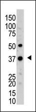 WB analysis of mouse kidney tissue lysate using GTX01069 UCHL5 antibody.